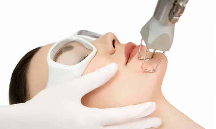 CO2-FRACTIONAL-LASER