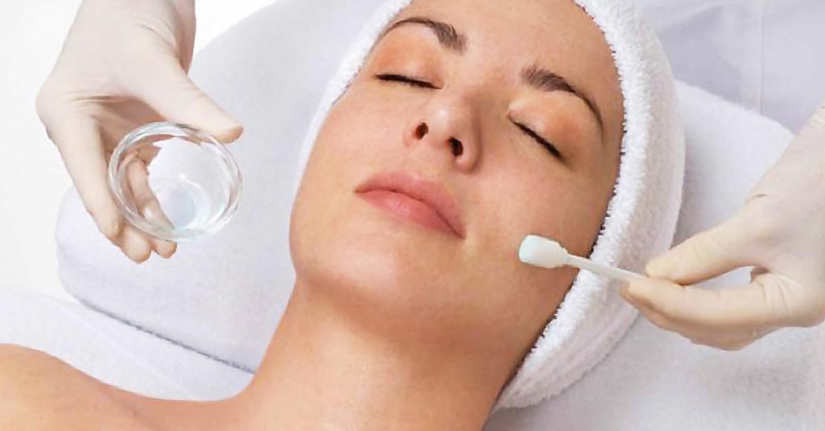 chemical-peels-2