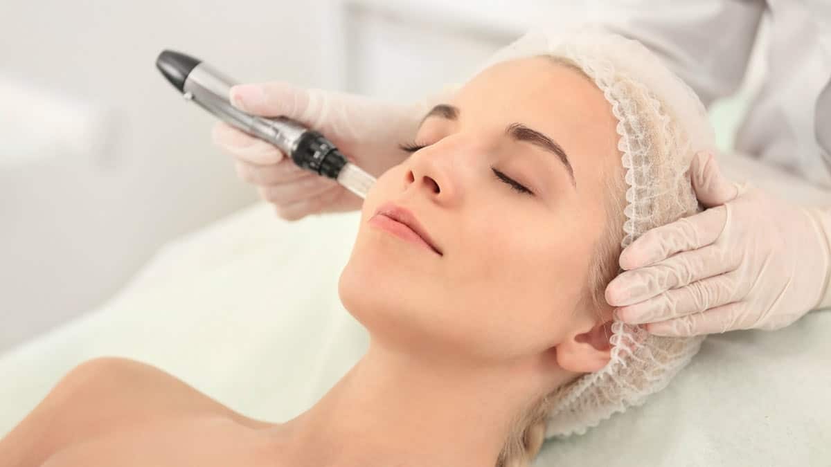 dermapen-microneedling