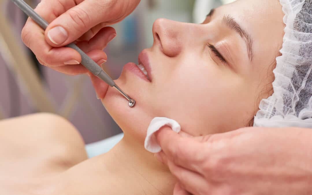 Face Clean / Comedone Extraction - 1 Session