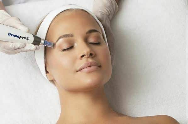 Dermapen - 1 Session 2 Dermapen - 1 Session