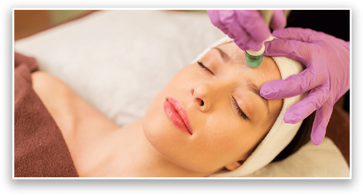 Dermapen - 1 Session 4 Dermapen - 1 Session