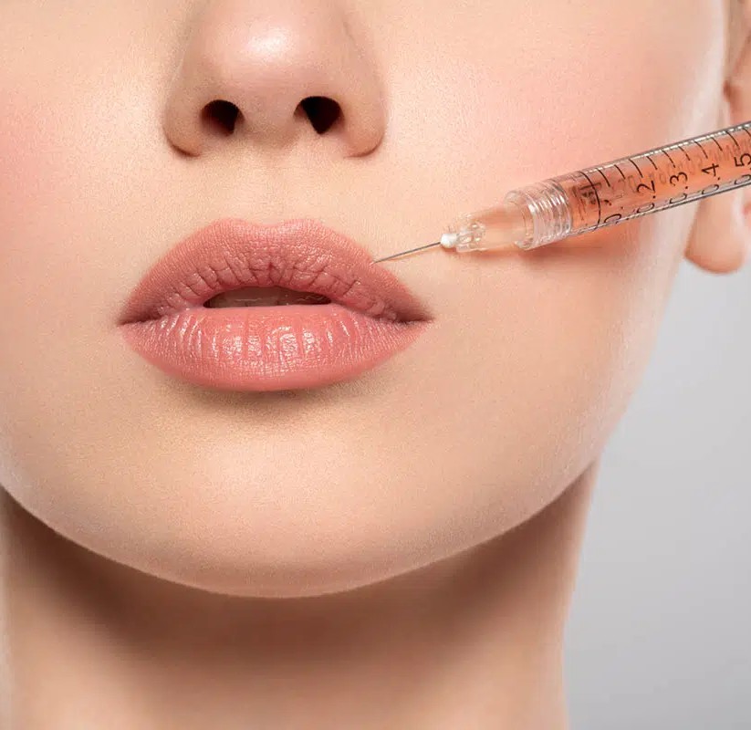 woman-getting-cosmetic-injection-of-filler-in-lips